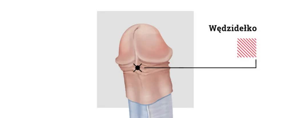 Czy kolczyk w wędzidełku boli? Poznaj prawdę o bólu i gojeniu