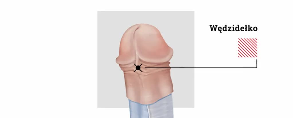 Czy kolczyk w wędzidełku boli? Poznaj prawdę o bólu i gojeniu
